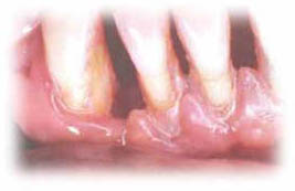 Picture of periodontal disease (courtesy of Case School of Dental Medicine)