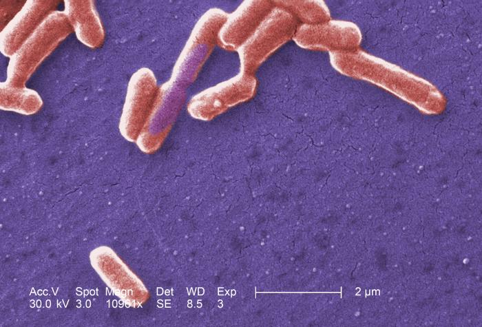 Photo Credit: CDC/ National Escherichia, Shigella, Vibrio Reference Unit at CDC