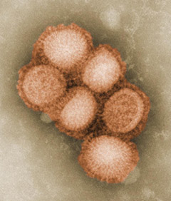 Swine Flu (H1N1)